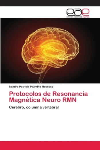Protocolos de Resonancia Magnetica Neuro RMN