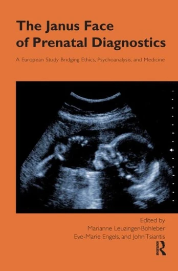 Janus Face of Prenatal Diagnostics