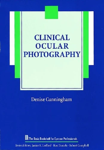 Clinical Ocular Photography