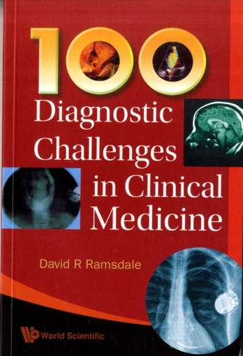 100 Diagnostic Challenges In Clinical Medicine