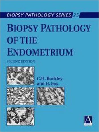 Biopsy Pathology of the Endometrium, 2Ed