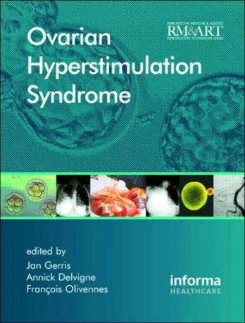 Ovarian Hyperstimulation Syndrome