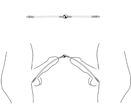 Dvigubas šlaplės dilatatorius, 24 cm
